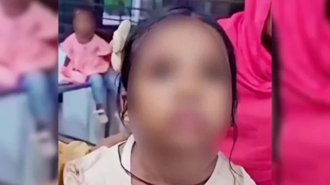 বিড়ালের আঁচড়ের পর শিশুর ‘মিউ মিউ’ শব্দ, যে কারণ জানালেন চিকিৎসক